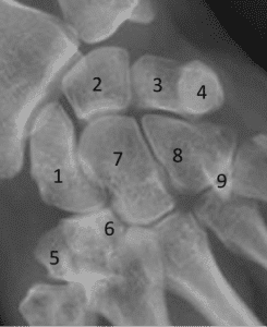 radiographie du carpe