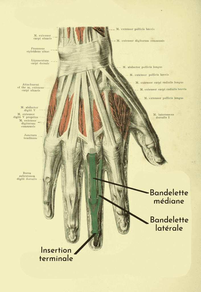 Schématisation de l'appareil extenseur des doigts longs